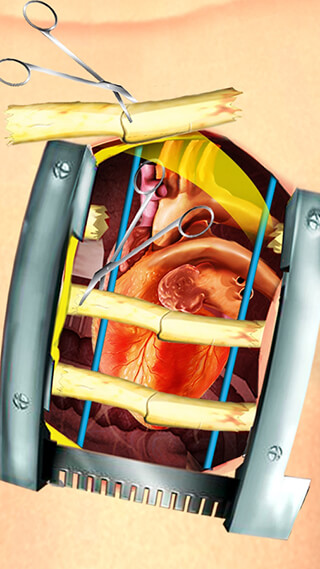 Open Heart Surgery Simulator скриншот 4